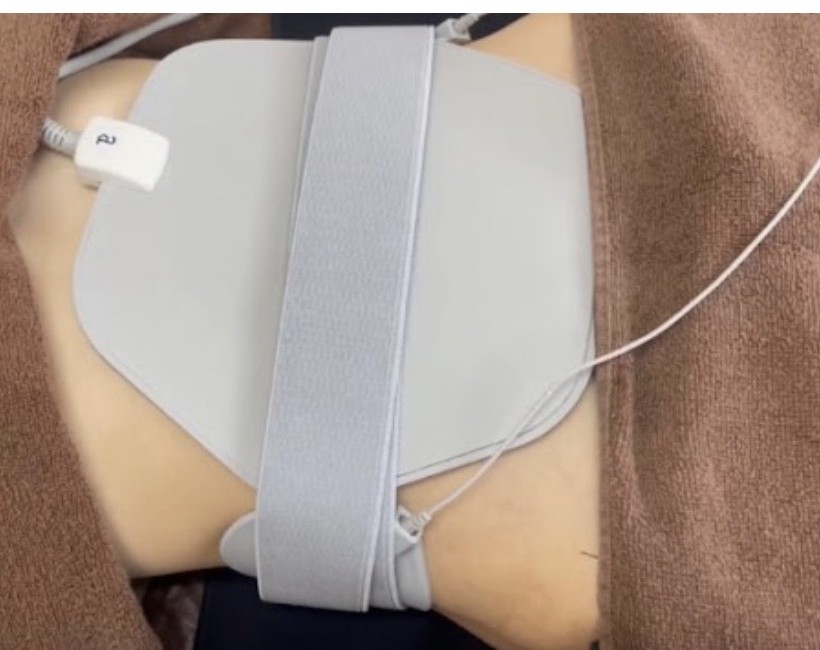 お腹にEMS機器を装着して施術している様子