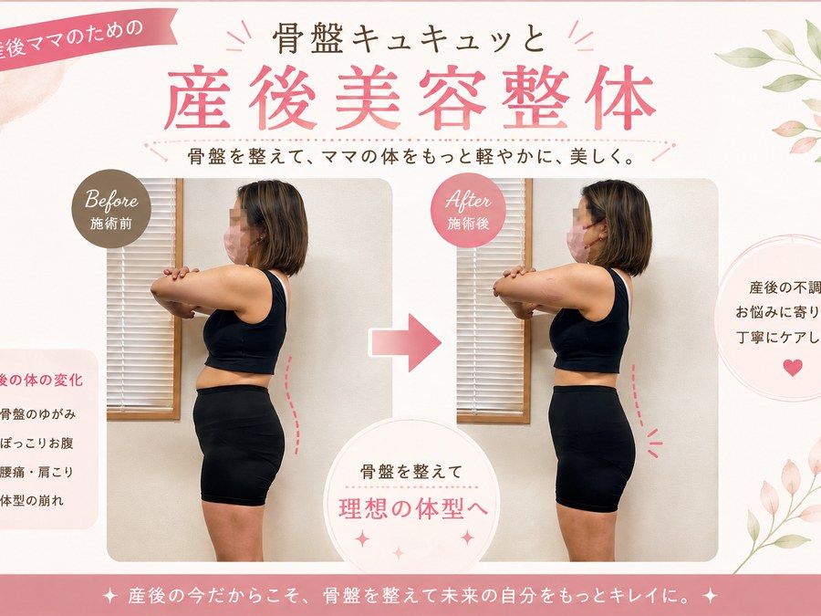 産後の骨盤ケアによる姿勢の変化がわかるBefore/After写真