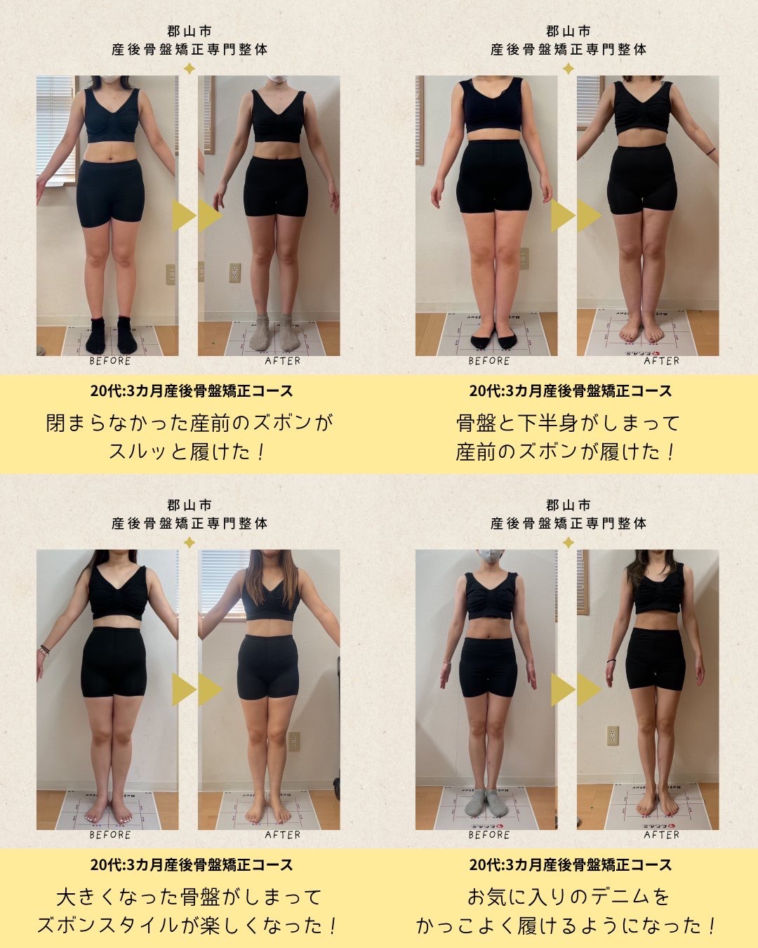 産後骨盤矯正の施術実績（正面から見たウエスト・身体のライン、複数症例）