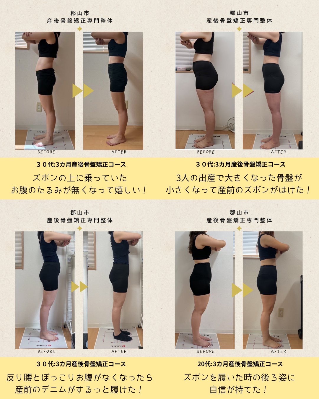 産後骨盤矯正の施術実績（横から見た姿勢・お腹まわりの変化、複数症例）